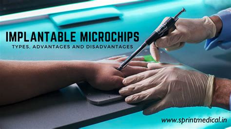 rfid chip implant kit|dangers of microchipping humans.